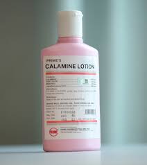 Calamine Lotion For Stretch Marks For Sale